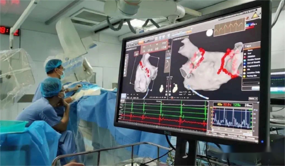 術(shù)中超聲成像新技術(shù)|心腔內(nèi)超聲（ICE）③臨床應(yīng)用篇